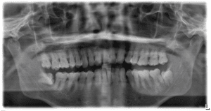 Case 2 Original Xray