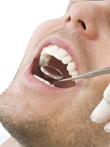 Close Up of Males Mouth With Dental Mirror Inside's Mouth With Dental Mirror Inside